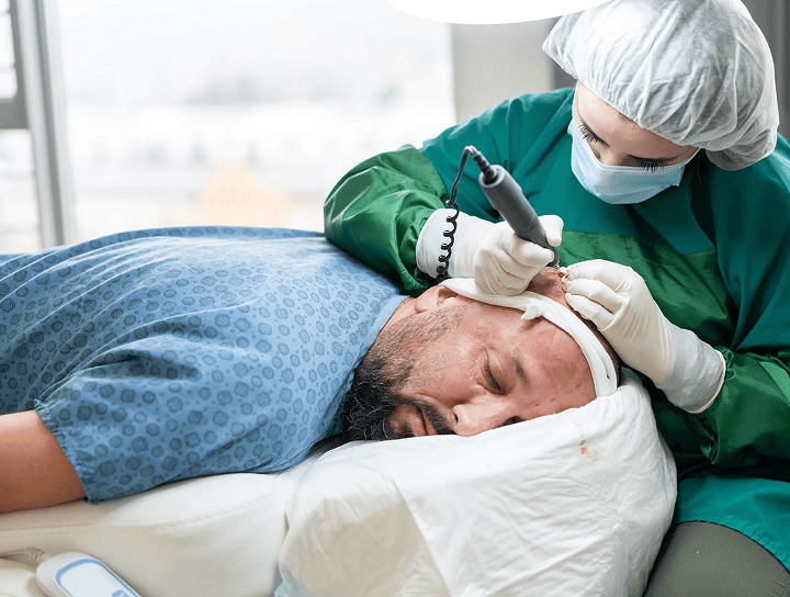 PROFESIONAL BACHELOR OF TRICHOLOGY AND HAIR TRANSPLANTATION